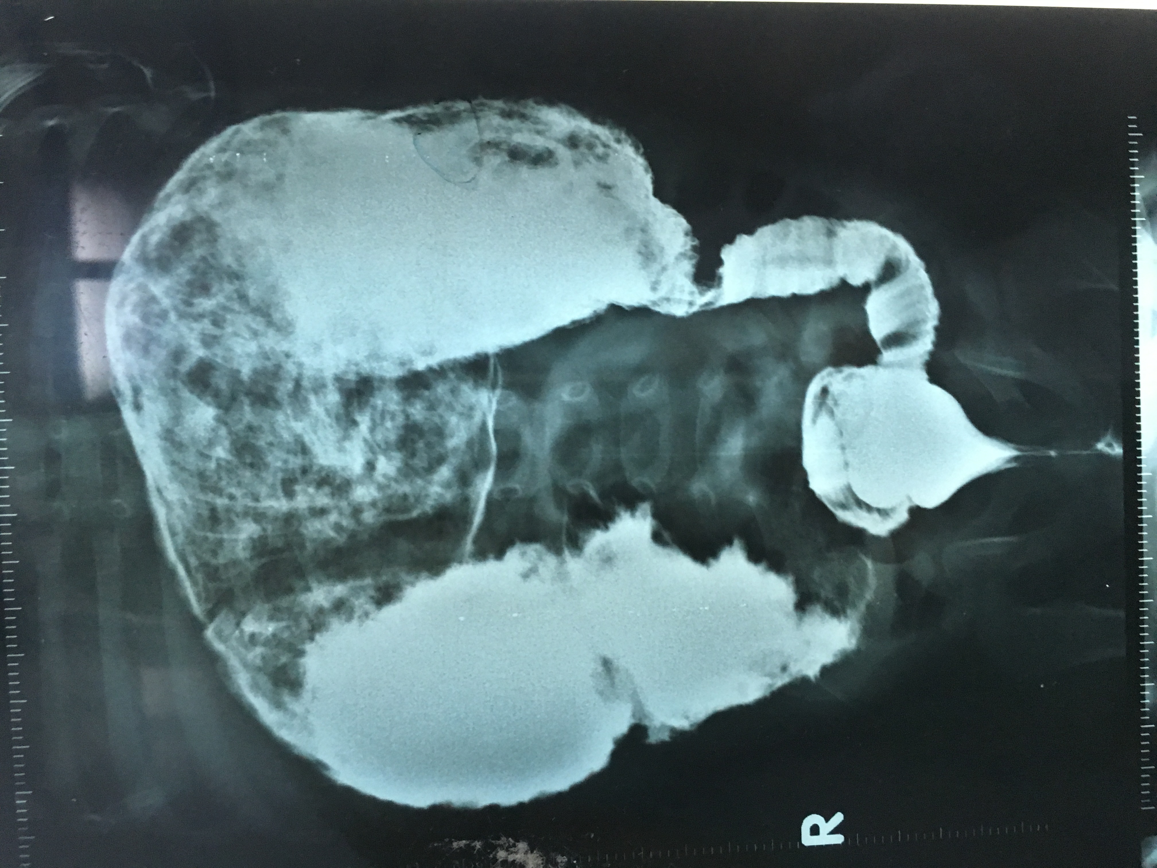 Pediatric G.I. Surgery Image 9